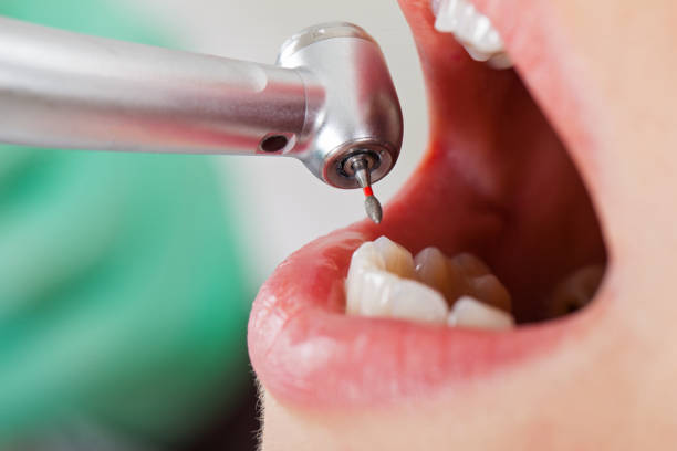Best Pediatric Emergency Dentist in Riverse, ID